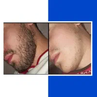 دستگاه اپلیکاتور ریش
