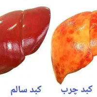 کمک به بهبودوپاکسازی کبدچرب