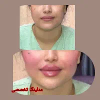 کلینیک پزشکی پوست ومو|خدمات آرایشگری و زیبایی|اهواز, زیتون کارمندی|دیوار