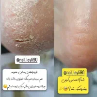کفسابی تخصصی پا و آموزش کفسابی  (الهیه)|خدمات آرایشگری و زیبایی|مشهد, جاهد شهر|دیوار