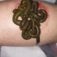 زالوی طبی  تبریز زالو|خدمات آرایشگری و زیبایی|تبریز, |دیوار