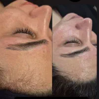 فیشیال و پاک سازی درمانی ۵۰۰ تومان گلستان،سعدی|خدمات آرایشگری و زیبایی|اهواز, کوی سعدی|دیوار