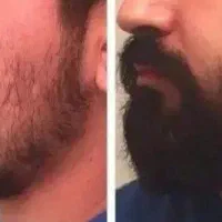 فکس