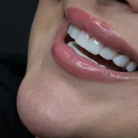 اهالی ورامین کامپوزیت با نازلترین قیمت