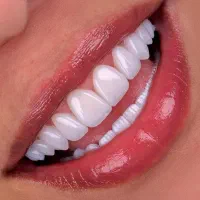 دندانپزشکی اقساطی،ایمپلنت فقط۱۳/۵ تومن