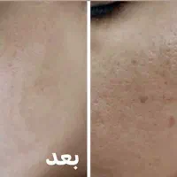 کامپوزیت دندان لیزرمو ژل بوتاکس فیلر مزو پی ارپی|خدمات آرایشگری و زیبایی|اسلامشهر, زرافشان|دیوار
