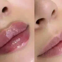 میکروبلیدینگ فیلرو بوتاکس شیدینگ تخفیف یلدایی|خدمات آرایشگری و زیبایی|بیرجند, |دیوار