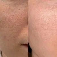پوستی صاف و بی نقص