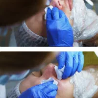 فیشیال حرفه‌ای پوست|خدمات آرایشگری و زیبایی|آباده, |دیوار
