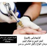 کرایو تراپی فریز زگیل تناسلی مقعد(تعرفه دولتی)