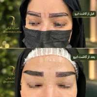 کاشت ابرو بصورت تمام اقساط|خدمات زیبایی و سلامت|شیراز, مهدیآباد|دیوار