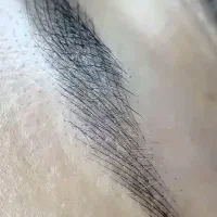 فیبروز و میکروبلید