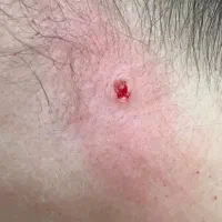 خال برداری|خدمات آرایشگری و زیبایی|قم, امامزاده ابراهیم|دیوار