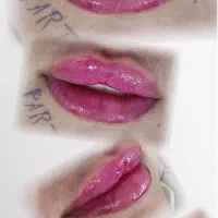 خدمات زیبایی بهترین نتایج با قیمت مناسب .ژل