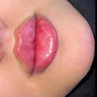 جشنواره تخفیف فیلر بوتاکس|خدمات آرایشگری و زیبایی|اهواز, کیانپارس |دیوار