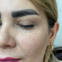 بلفارو پلاستی بالا و پایین|خدمات آرایشگری و زیبایی|تهران, شهران جنوبی|دیوار
