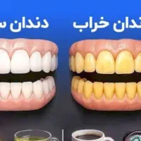 یونیت دندان پزشکی پرتی