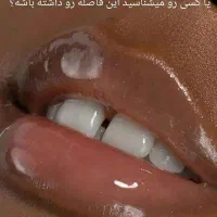 ترمیم و پر کردن دندان فقط ۱ میلیون و ۳۰۰|خدمات آرایشگری و زیبایی|ورامین, خیر آباد|دیوار