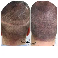 میکرواسکالپ سر، میکروبلیدینگ ابرو، شیدینگ لب|خدمات آرایشگری و زیبایی|شاهین‌شهر, فردوسی|دیوار