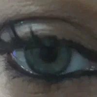 کاشت مژه هیدن حرفه ای