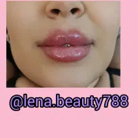 خدمات ژل فقط ۵۸۰ وبوتاکس ۷۵۰ در مطب