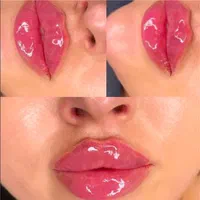 کلینیک ژل لب روسی و بوتاکس و آنزیم فیلر مطب پزشک|خدمات آرایشگری و زیبایی|کرج, گوهردشت|دیوار