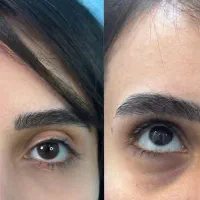 تخفیف ویژه تزریق فیلر|خدمات آرایشگری و زیبایی|اندیشه, اندیشه فاز ۱|دیوار