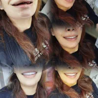 جشنواره دندان مصنوعی خارجی ژله ای با بیمه وضمانت|خدمات آرایشگری و زیبایی|کرج, مصباح|دیوار