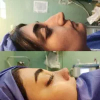 جشنواره جراحی و عمل بینی در کرج و تهران|خدمات آرایشگری و زیبایی|کرج, عظیمیه|دیوار