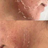 مدل برای پکیج های پوستی