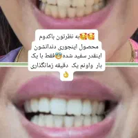اسپری سفید کننده دندان وخوشبوکننده دهان|آرایشی، بهداشتی، درمانی|زاهدان, |دیوار