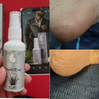 معجزه ای همه کاره بنام تونیک نانو کلوئید نقره|آرایشی، بهداشتی، درمانی|تهران, الهیه|دیوار