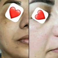 کرم سفید کننده مروه گلی یا همون القمر|آرایشی، بهداشتی، درمانی|میبد, |دیوار