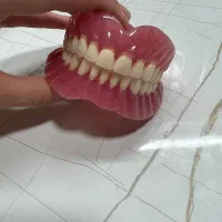دندان مصنوعی ارزان/ تحویل یکروزه/سراسر تهران|خدمات زیبایی و سلامت|تهران, توحید|دیوار