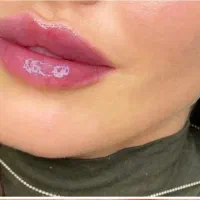 ژل و بوتاکس با تخفیف استثنایی|خدمات آرایشگری و زیبایی|جیرفت, |دیوار