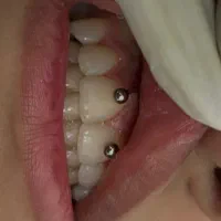 خدمات تخصصی پیرسینگ