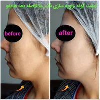 جشنواره  تابستانه ی هایفو ۷ بعدی فقط به مدت ۱۰ روز|خدمات آرایشگری و زیبایی|تهران, آسمان|دیوار