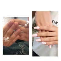 کاشت .ژلیش .لینمت .ترمیم و ماندگاری عالی و