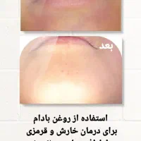 درمان از دل طبیعت|آرایشی، بهداشتی، درمانی|حمیدیه, |دیوار