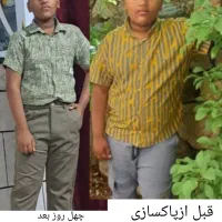 مینی پک لاغری تخفیف ویژه شب یلدا|فعالیت داوطلبانه|بندرعباس, |دیوار