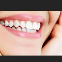 کامپوزیت دندان لمینت «با سفته» درمشهد