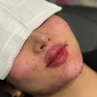 مرکز تخصصی ژل بوتاکس /کاشت امبدینگ لاغری در مطب|خدمات آرایشگری و زیبایی|کرمانشاه, |دیوار