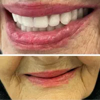 دندان مصنوعی و دندانسازی ، خدمات دندان سازی|خدمات آرایشگری و زیبایی|مشهد, شفا|دیوار