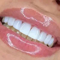 کلیه خدمات دندانپزشکی با تخفیفات طلایی|خدمات زیبایی و سلامت|کرمانشاه, |دیوار