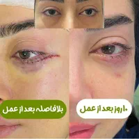 عمل جراحی بینی، ترمیمی،  لیفت صورت،  لیپو ابدو|خدمات آرایشگری و زیبایی|تهران, نارمک|دیوار