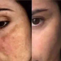 قوی ترین ضدلک دنیا با ضمانت مرجوعی