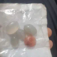 سنگ قیمتی قدیمی ۵کوچیک عقیق بزرگ نمیدونم چیه