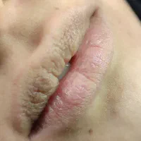 تخفیفات ویژه خدمات آرایش دائم صورت