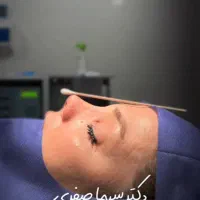 جراحی زیبایی بینی صفرتاصد ۲۹تومان متخصص(ent)|خدمات آرایشگری و زیبایی|تهران, یوسف‌آباد|دیوار