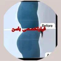 ساکش غبغب تزریق .باسن.شکم|خدمات آرایشگری و زیبایی|کرمانشاه, |دیوار